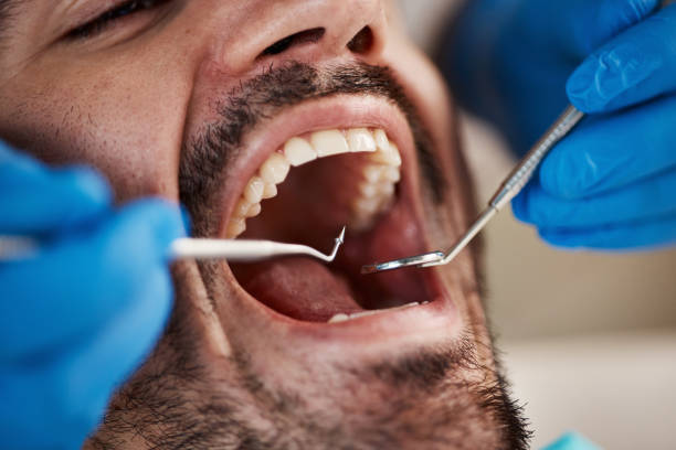 Best Emergency Treatment for Oral Infections in Carrollton, KY